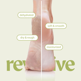 Innerest Foot Mask – exfoliation action reveals smoother skin after wear