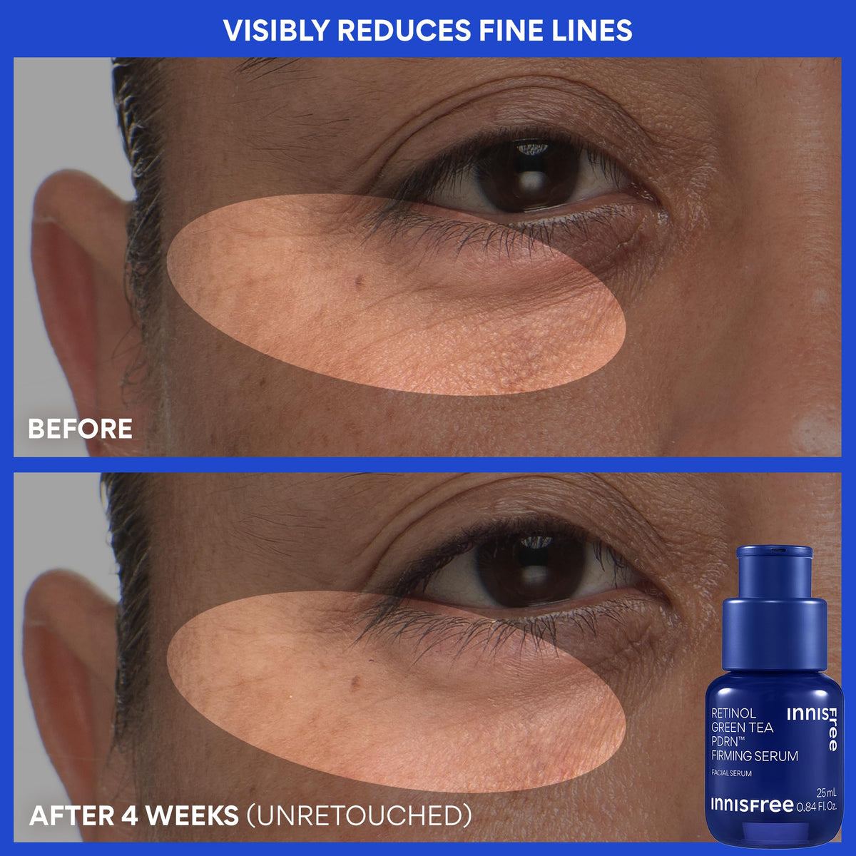 Innisfree Toner application close-up demonstrates gentle patting for even absorption.