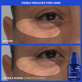 Innisfree Toner application close-up demonstrates gentle patting for even absorption.