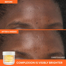 Innisfree Vitamin C Cream and Serum duo shown for a radiant finish