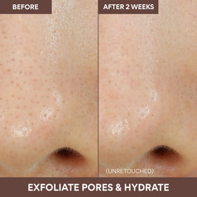Innisfree Volcanic Swirl Pore Mask dual-chamber design supports an efficient routine.