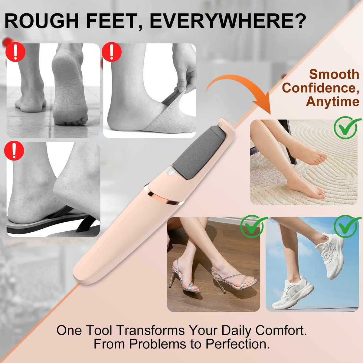Innoflyx fine-head callus remover for silky-soft feet