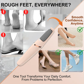 Innoflyx fine-head callus remover for silky-soft feet
