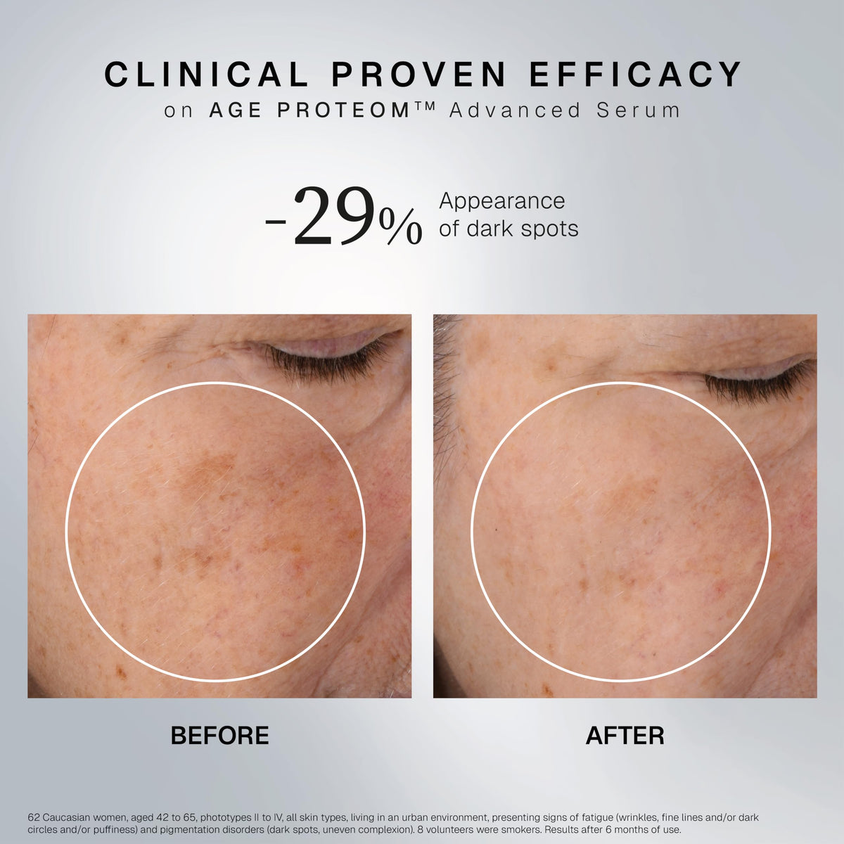 INSTITUT ESTHEDERM AGE PROTEOM ADVANCED SERUM rich texture with quick-absorption benefits.