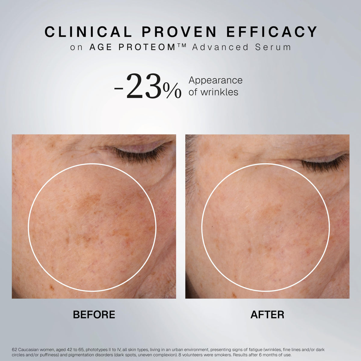 INSTITUT ESTHEDERM AGE PROTEOM ADVANCED SERUM 1-oz packaging suits travel and routines.
