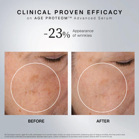 INSTITUT ESTHEDERM AGE PROTEOM ADVANCED SERUM 1-oz packaging suits travel and routines.
