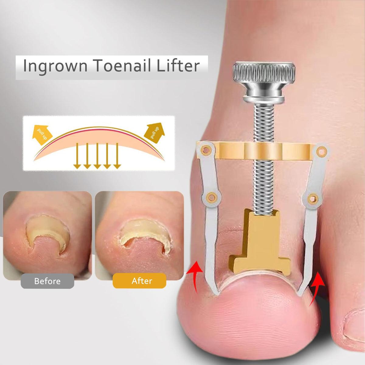 Innysh dead skin fork tool for pedicure prep