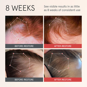 iRestore Scalp Serum application close-up shows rapid absorption with a light, non-greasy feel.