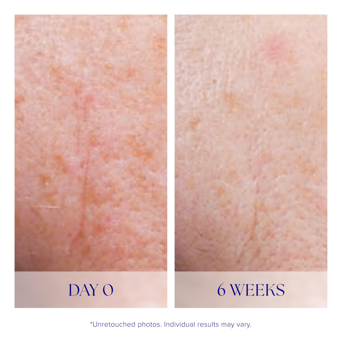 iS CLINICAL Active Serum pump dispensing for easy daily use.