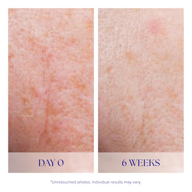 iS CLINICAL Active Serum pump dispensing for easy daily use.