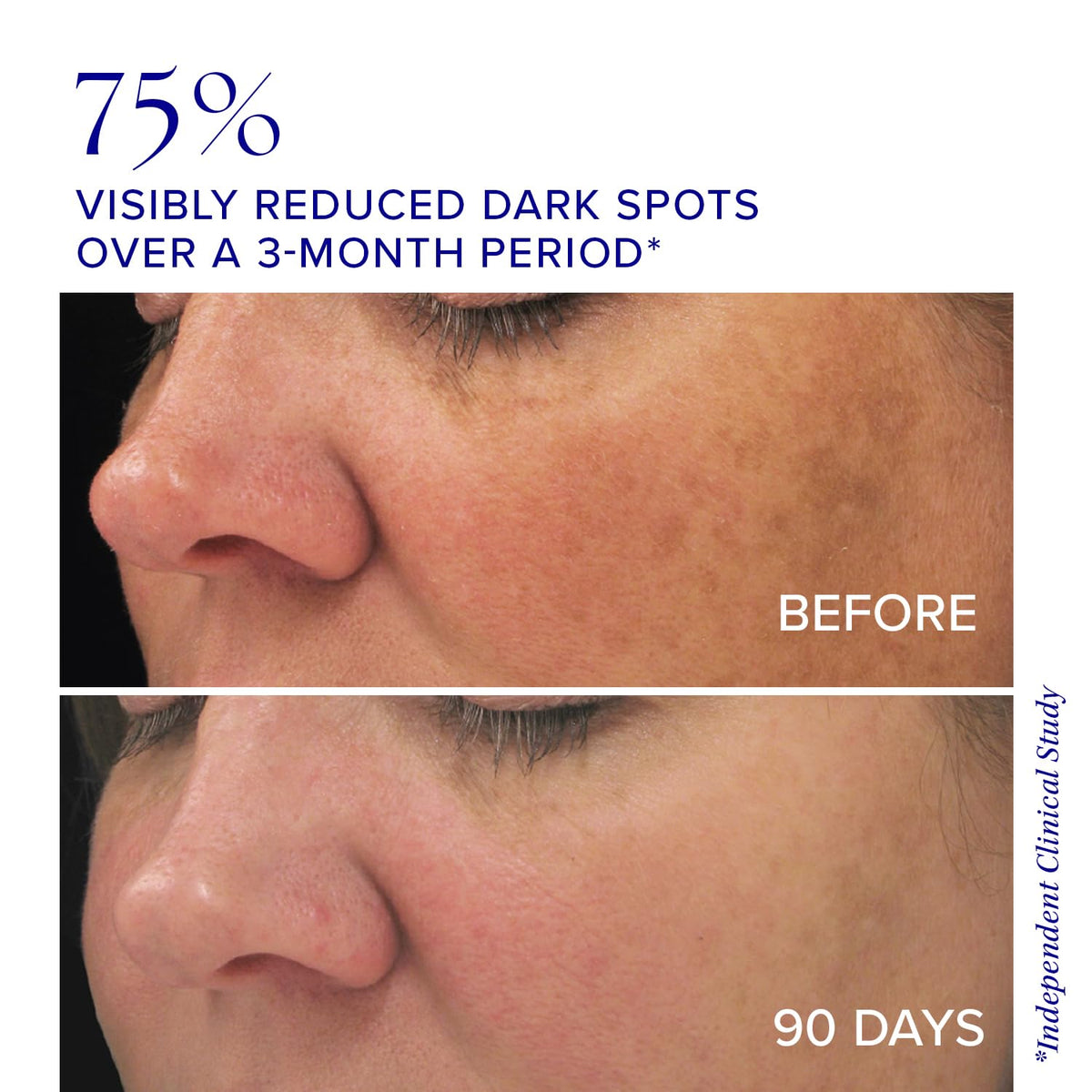 is Clinical Brightening Complex dropper application demonstrating easy daily use