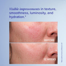 iS CLINICAL Retinol+ Emulsion 0.3 texture closeup showing gentle resurfacing