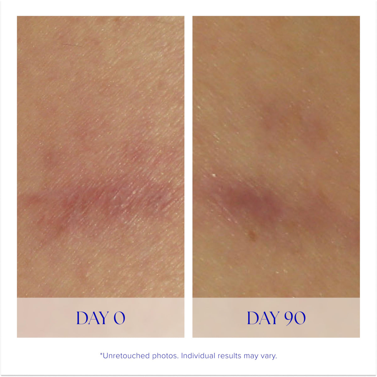 iS CLINICAL Super Serum Advance+ texture close-up indicating quick absorption