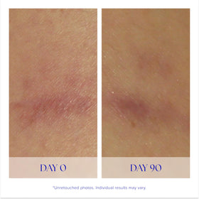 iS CLINICAL Super Serum Advance+ texture close-up indicating quick absorption
