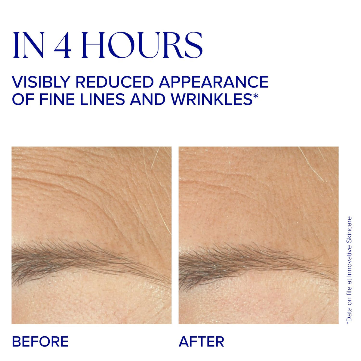 IS CLINICAL Youth Complex texture application demonstrates smoothing and immediate hydration