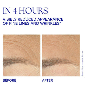 IS CLINICAL Youth Complex texture application demonstrates smoothing and immediate hydration