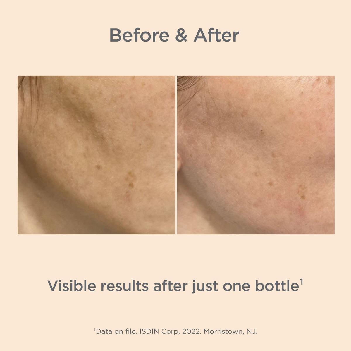 ISDIN Melaclear Advanced brightening effect suggests even skin tone over time.
