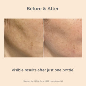 ISDIN Melaclear Advanced gel-serum delivers smooth, hydrating touch.