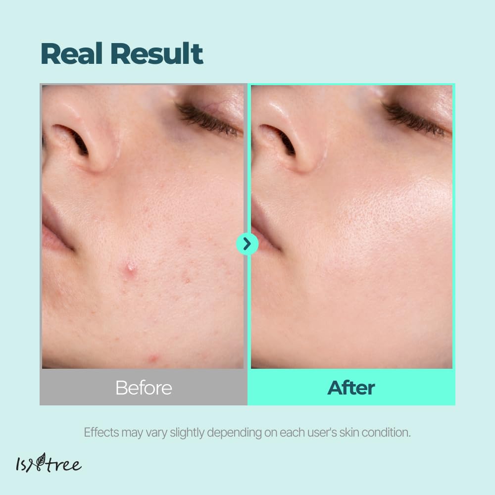 IsNtree Gim PDRN Deep Sleep Mask night routine step for hydration boost.