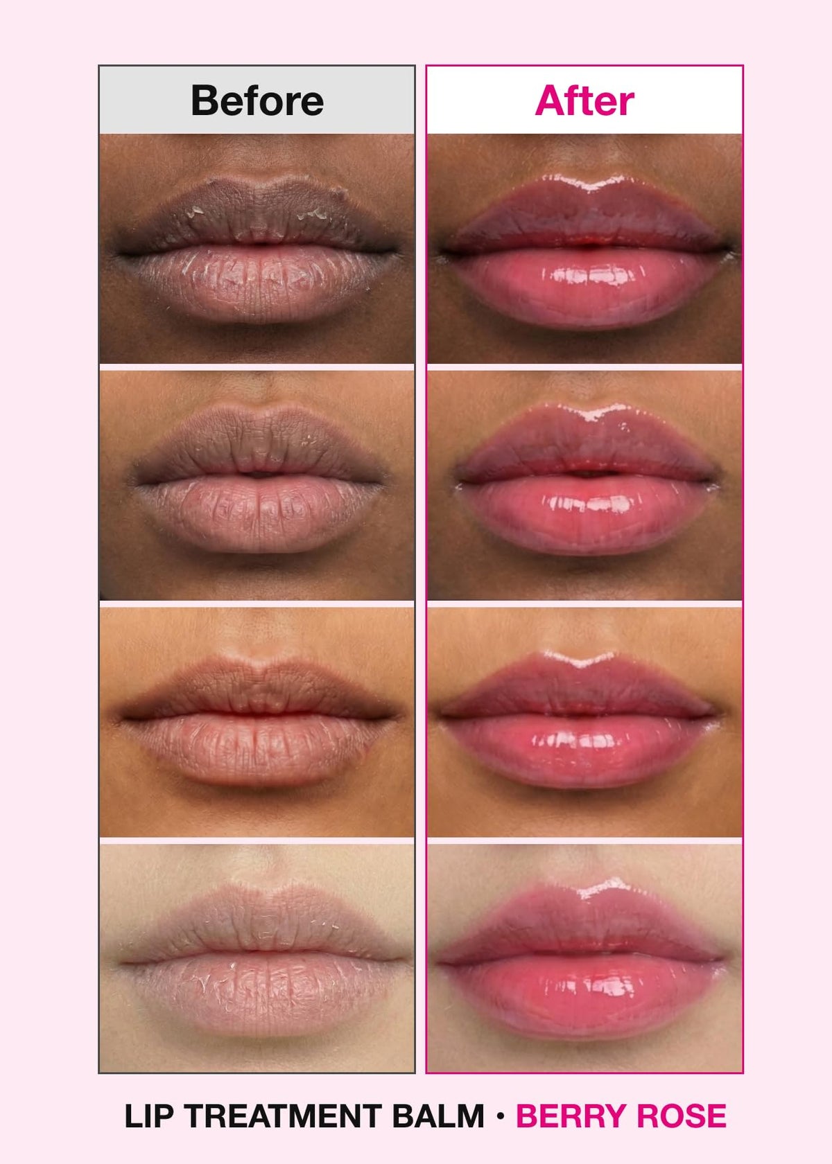 ISOI Bulgarian Rose Lip Treatment Balm hydrates and brightens daily.