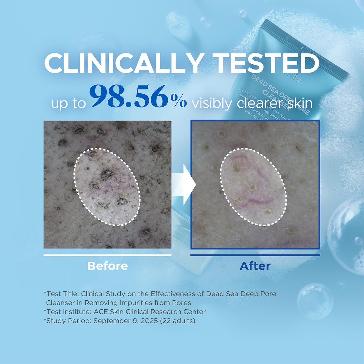 it:fu Deep Pore 2-in-1 cleanser foam demonstrates refreshing cleansing and pore unclogging