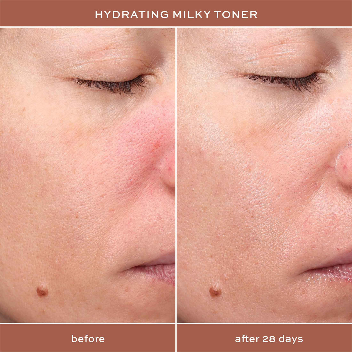 ITK Toner application on clean skin demonstrates gentle prep and moisture balance.