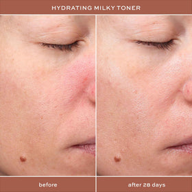 ITK Toner application on clean skin demonstrates gentle prep and moisture balance.