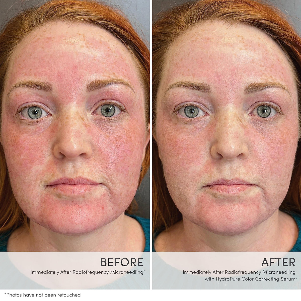 Jane Iredale HydroPure finish delivers a soft dewy glow on the skin.