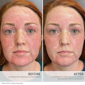 Jane Iredale HydroPure finish delivers a soft dewy glow on the skin.