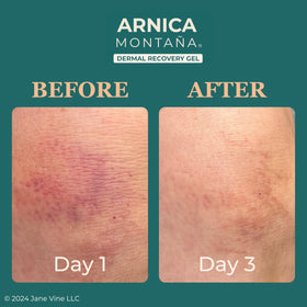 Jane Vine Arnica Gel with aloe and calendula, soothing for sensitive skin.