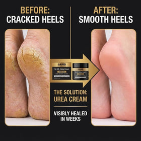 Jaws Podiatry Urea Cream deep hydration for dry heels.