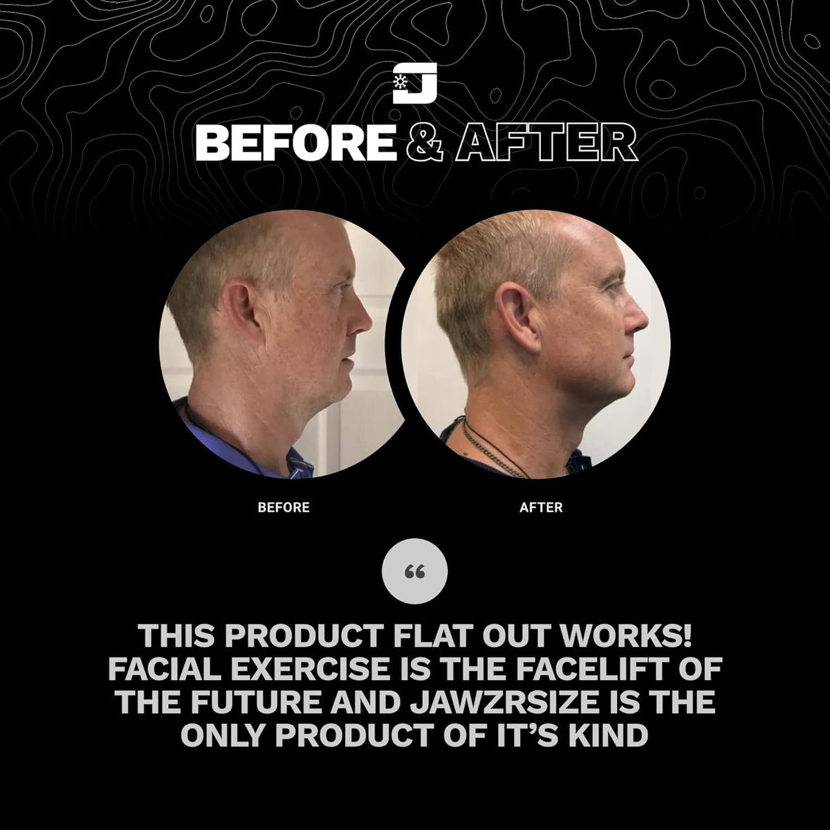 Jawzrsize jawline shaper silhouette demonstrating a streamlined profile and enhanced contour.