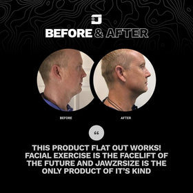 Jawzrsize jawline shaper silhouette demonstrating a streamlined profile and enhanced contour.