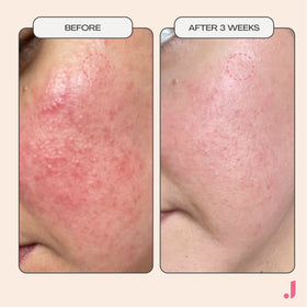 JESS BEAUTY Post Workout Gel Mask Niacinamide segment for pore refinement