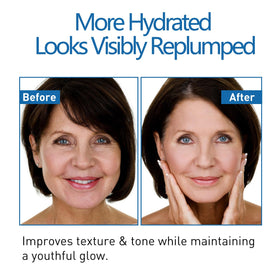JHKED Hyaluronic acid hydration concept visual highlighting deep moisture.