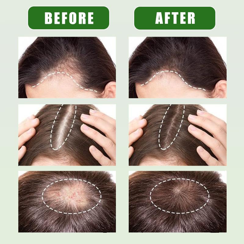 Jiokiyo Batana oil paste texture ready for scalp nourishment.