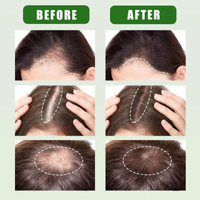 Jiokiyo Batana oil paste texture ready for scalp nourishment.
