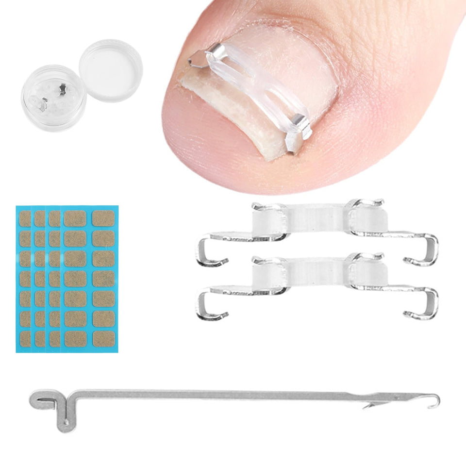 JIUDOUCUO ingrown nail correction clip in use for discreet wear
