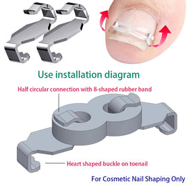 JIUDOUCUO adjustable tension band demonstrating nail growth support