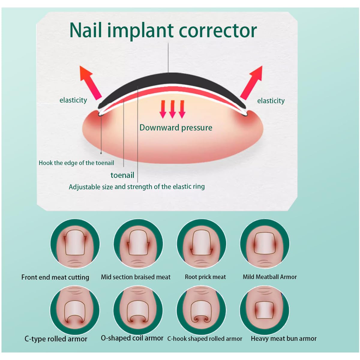 JIUDOUCUO universal sizing band adapting to nail width