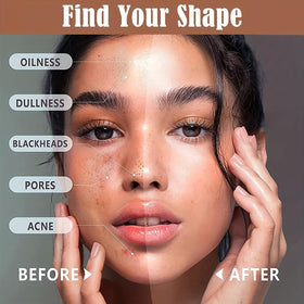 Joyeee high-coverage concealer palette hides blemishes and dark spots.