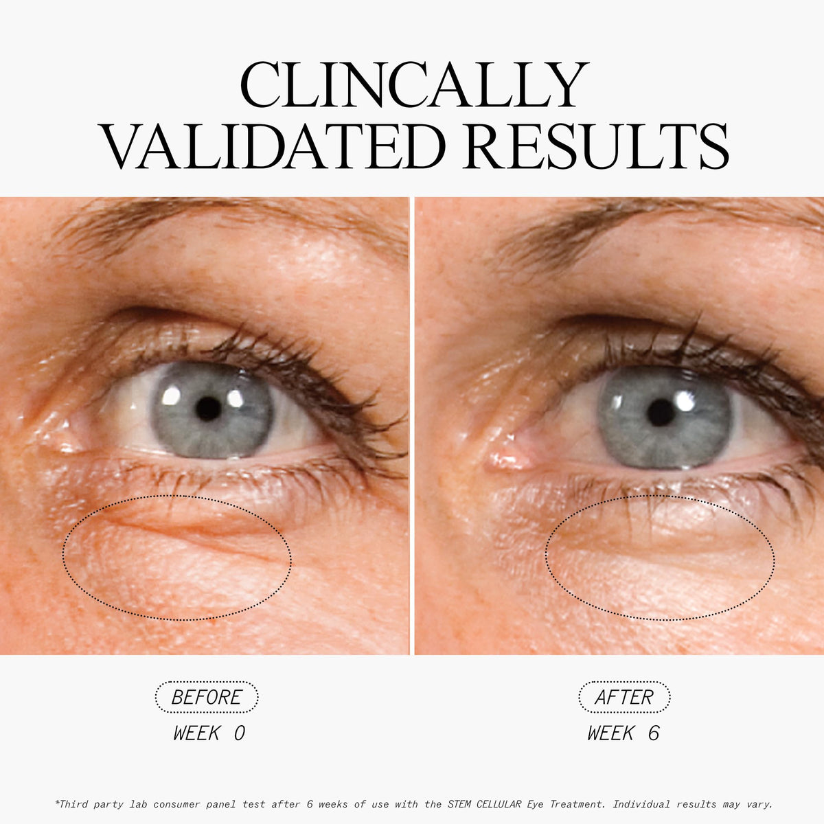 Juice Beauty Stem Cellular Eye Treatment daily ritual promotes a rested look around the eyes.