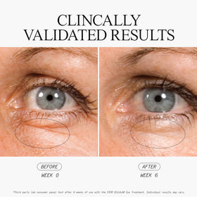 Juice Beauty Stem Cellular Eye Treatment daily ritual promotes a rested look around the eyes.