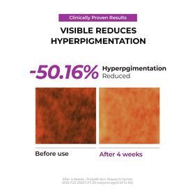 JUMISO Niacinamide 5+ Overnight barrier care with ceramide and squalane