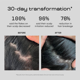 Jupiter Balancing Shampoo back label describes zinc pyrithione benefits