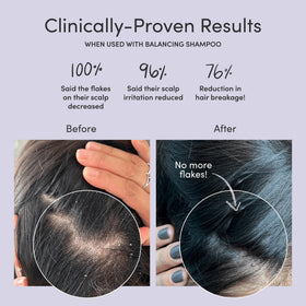Jupiter Scalp Mask removes oil and buildup for refreshed scalp.
