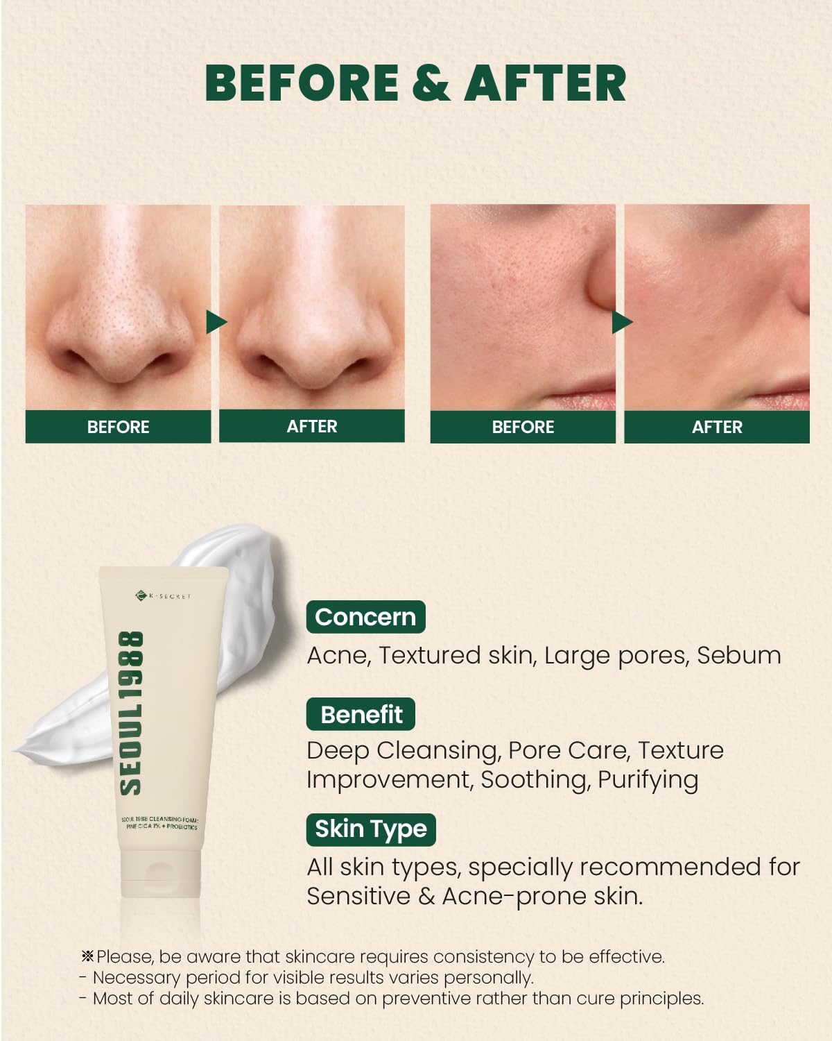 K-SECRET Seoul 1988 Cica Cleansing Foam pine cica complex calms skin