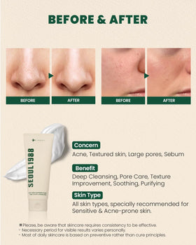 K-SECRET Seoul 1988 Cica Cleansing Foam pine cica complex calms skin
