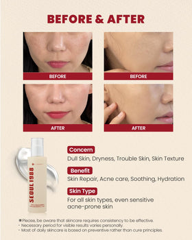 Applying K-SECRET Seoul 1988 essence for soothing comfort on sensitive skin.