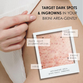 Kaia Naturals Takesumi Bright 10% azelaic acid formula targets bikini-line pigmentation.